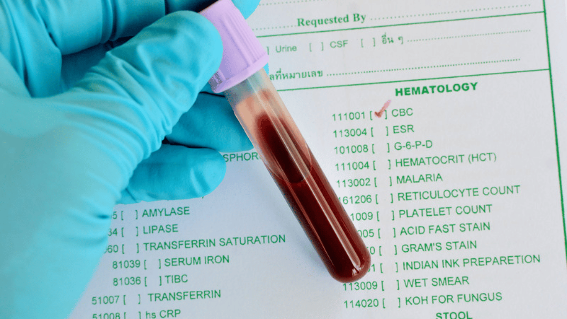 Provetta di sangue con tappo lilla tenuta da una mano guantata sopra un modulo di richiesta di analisi di laboratorio